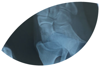 Radiografía médica en Sevilla