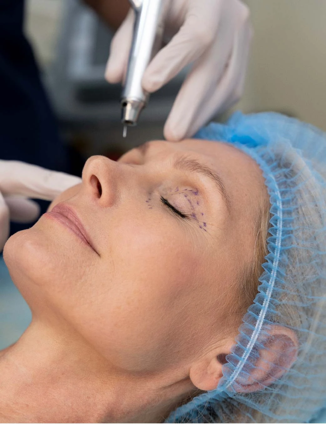 Clinica Osten Cirugía Facial